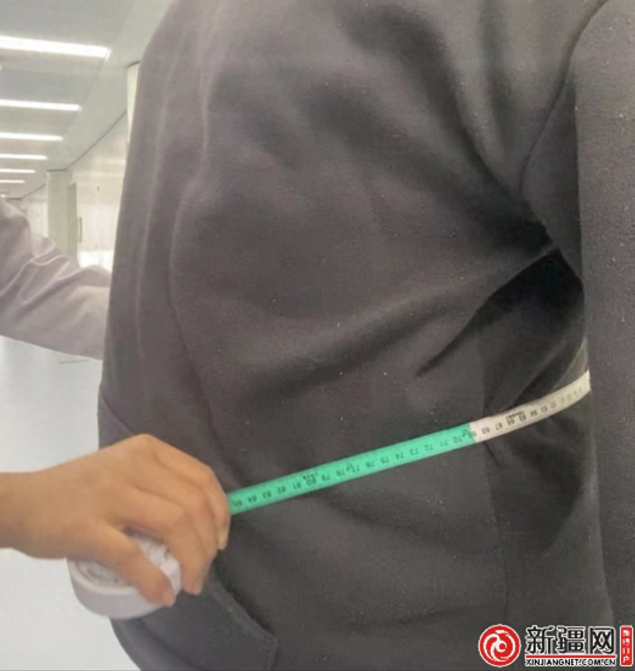 乌鲁木齐市友谊医院内分泌科开展新项目：专业疗法减重控糖今